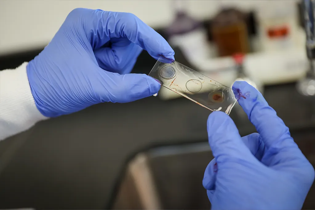 Gloved hands hold a prepared microscope slide with blood smears up to the light in a lab.