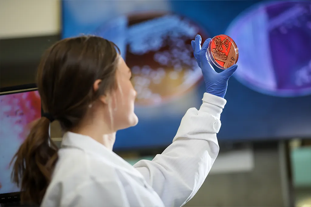 A medical laboratory science student in a lab coat and gloves examines a blood agar culture plate.